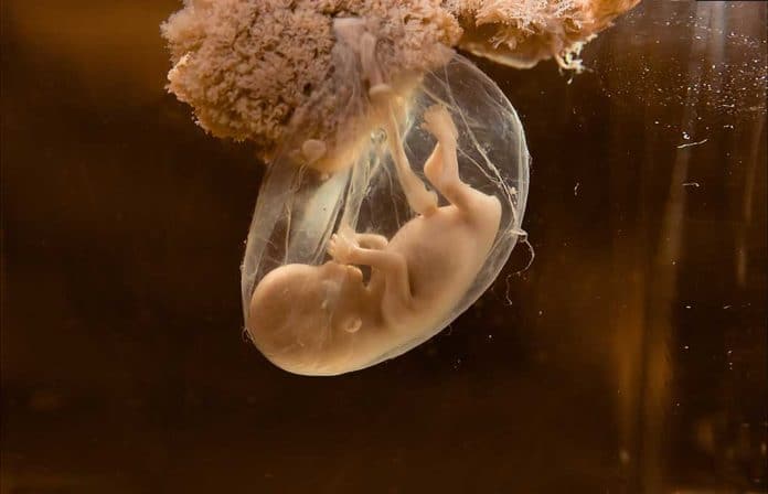 Donated Embryo Gives Window to Rarely-Seen Part of Human Development